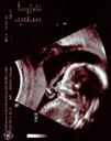 The Real Echogram pic 1