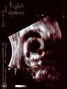 The Real Echogram pic 2