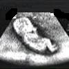 Echogram - At my place in Mummy's tummy